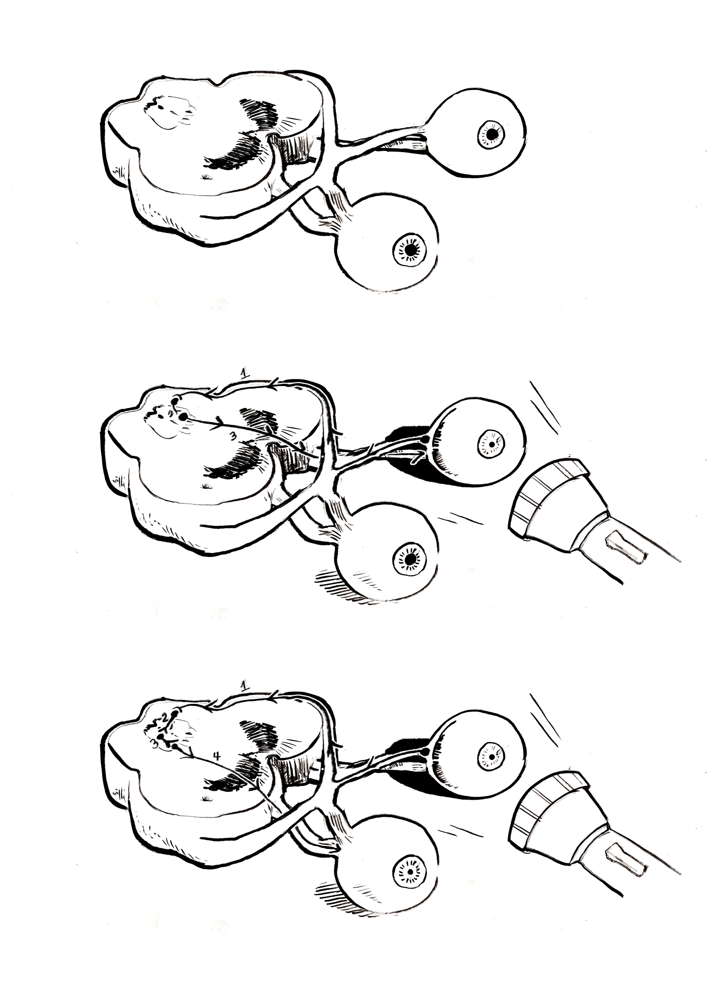 Images depicting the pupillary light reflex. Brush and ink, 2024.