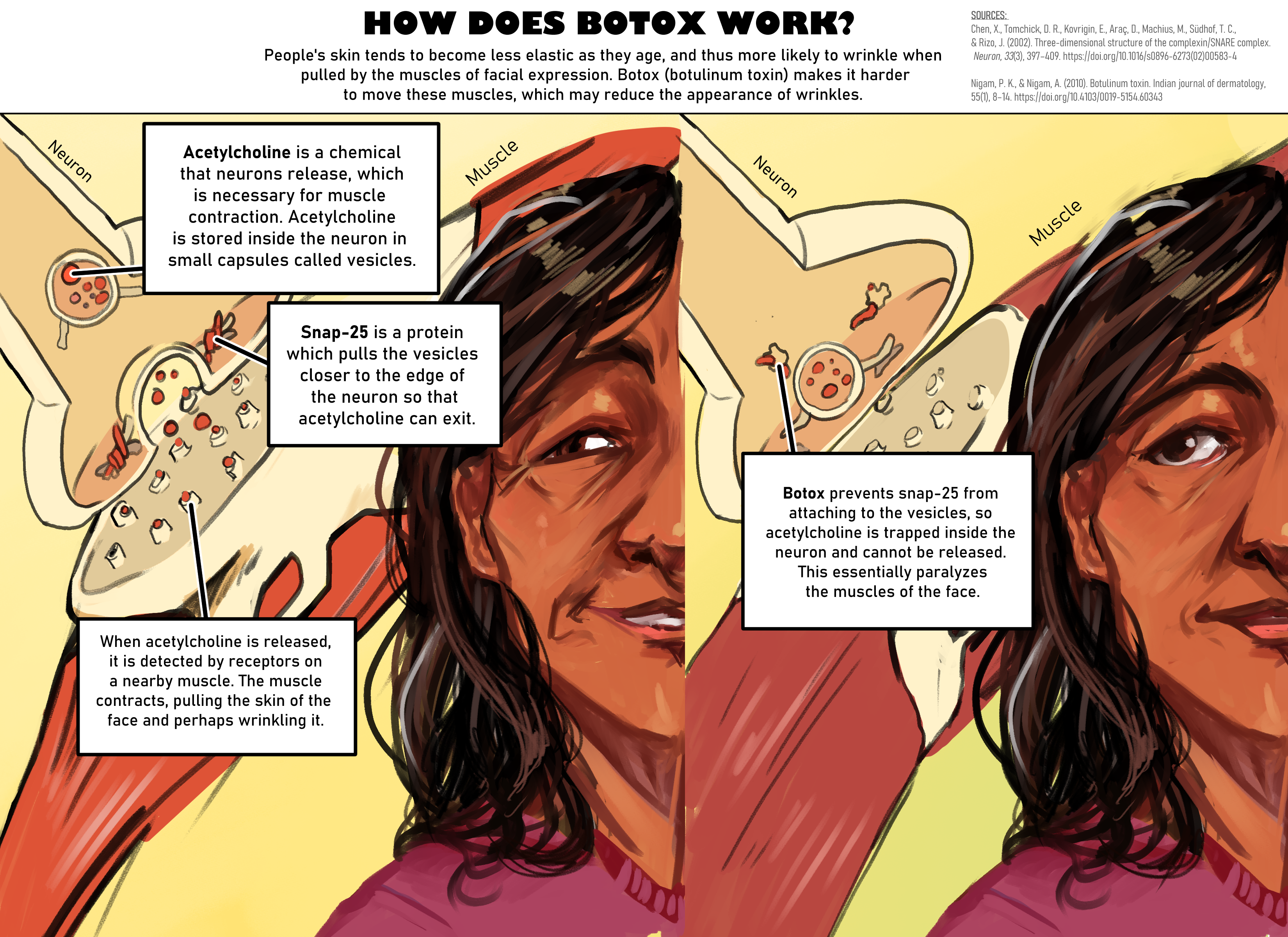 A non-stigmatizing look at the mechanism of action of botulinum toxin. Clip Studio Paint, 2022.